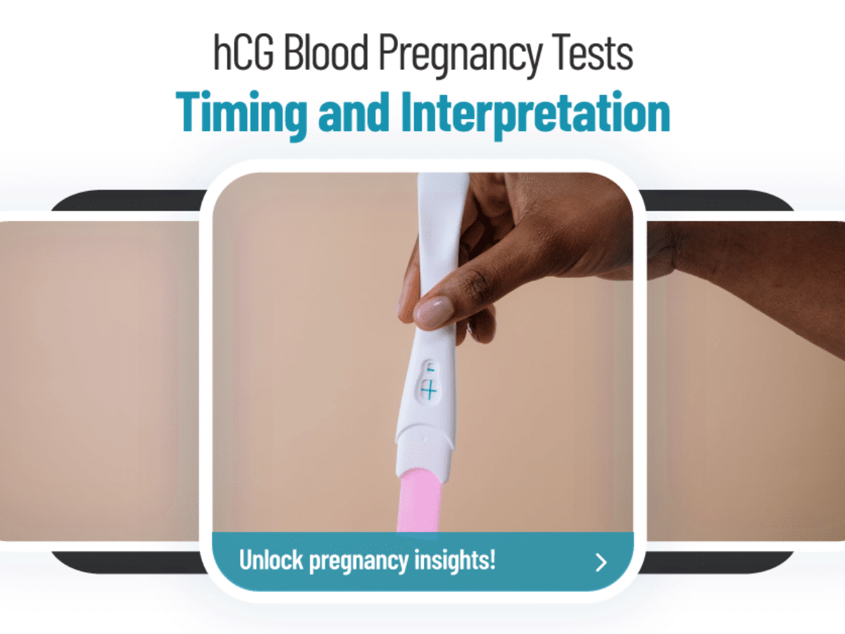 Timing and Interpretation of hCG Blood Pregnancy Tests   Sher ...